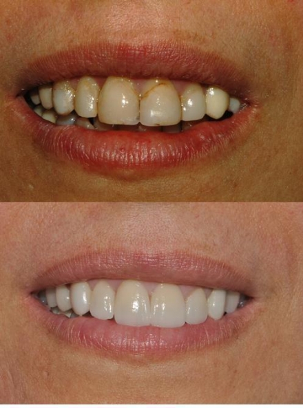 Come riconoscere un dentista estetico - Faccette Dentali Estetiche